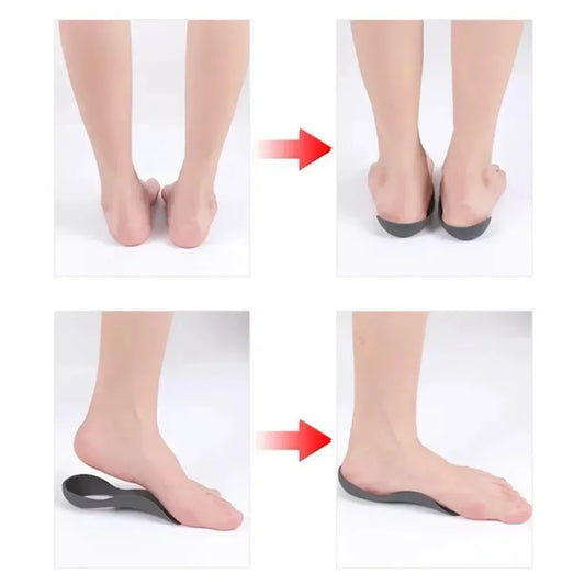 Orthotic Insoles Arch Support TPR Shoe Inserts for Flat Feet