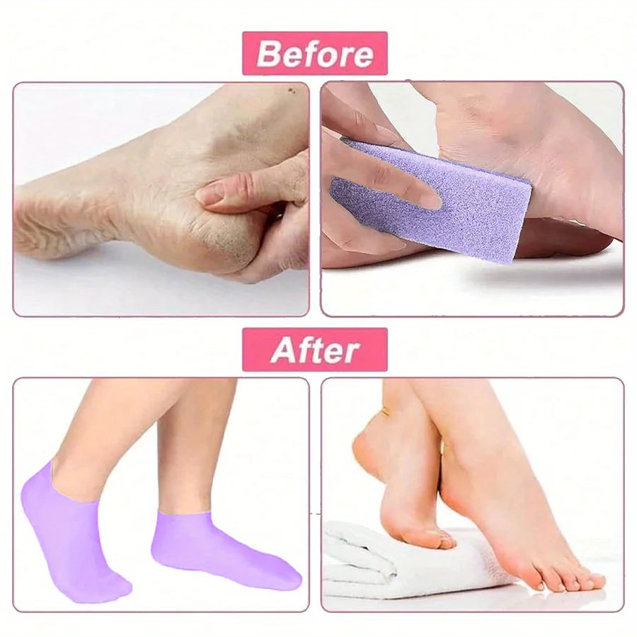 Moisturizing Foot Socks for Dry & Cracked Feet Silicone Heel Care