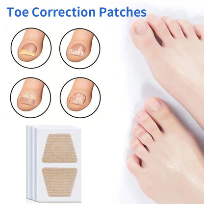 Toenail Repair Patches Nail Care Stickers for Damaged Nails